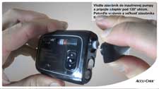 Nastavenie inzulínovej pumpy Accu-Chek® Insight
